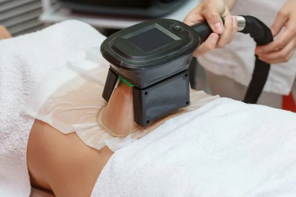 Image of person having fat freezing treatment to help weight gain Pudsey